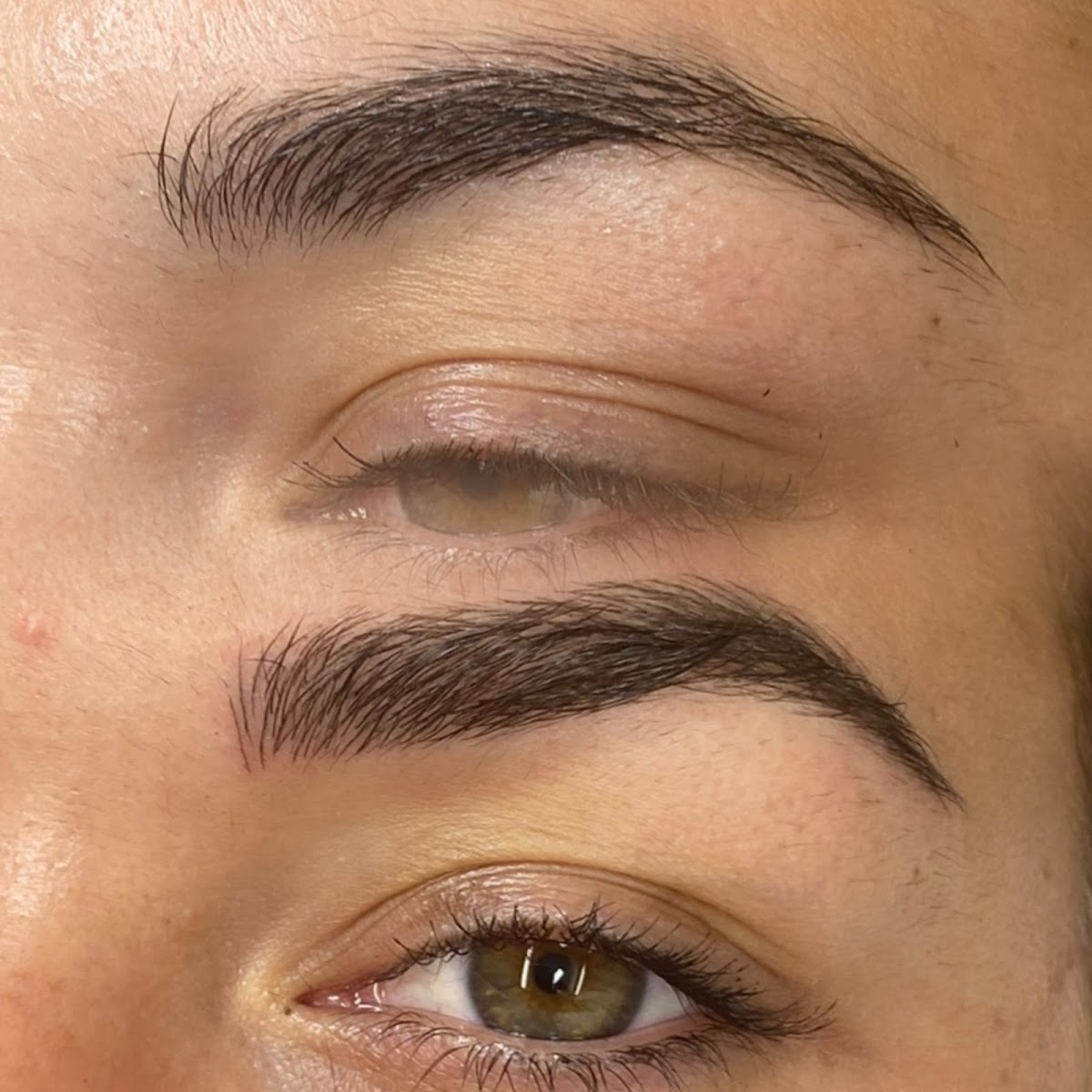 Linia Estetica