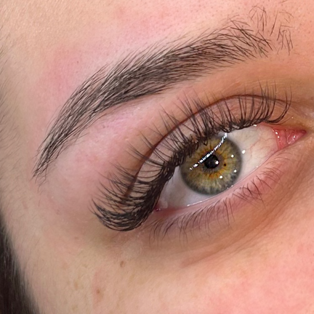 Freckled Esthetics
