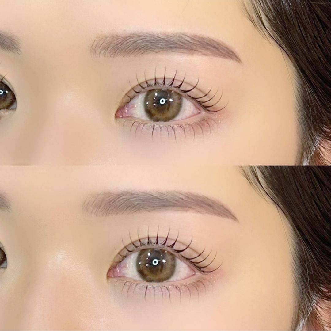 Lorraine Brow