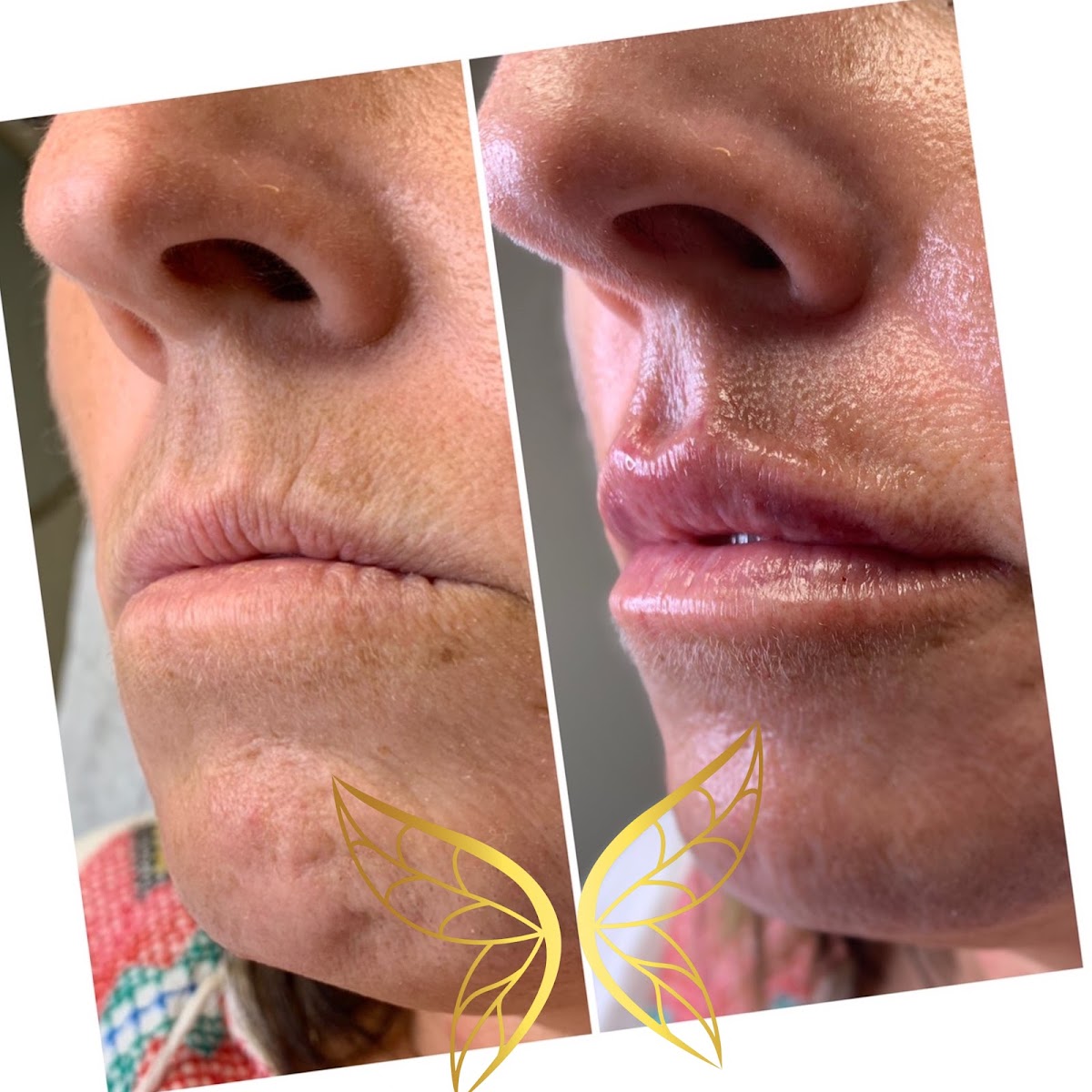 Monarch Medical Esthetics