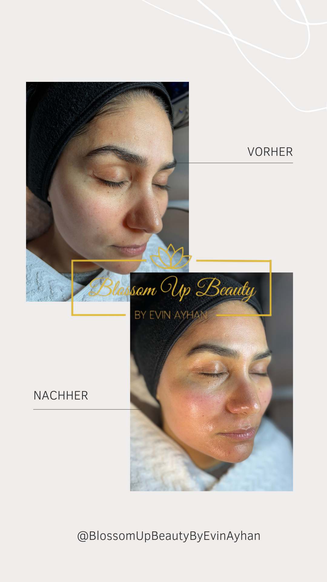 Blossom Up Beauty by Evin Ayhan
