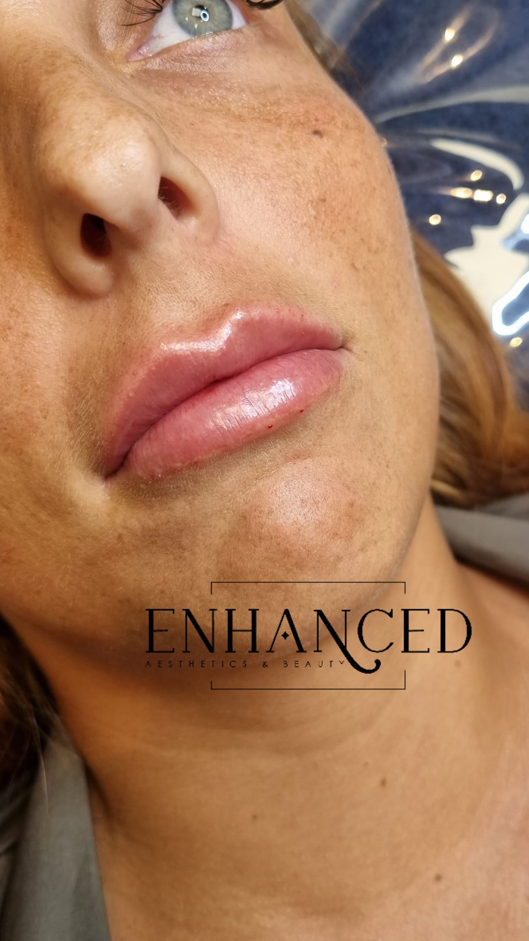 Enhanced Aesthetics & Beauty