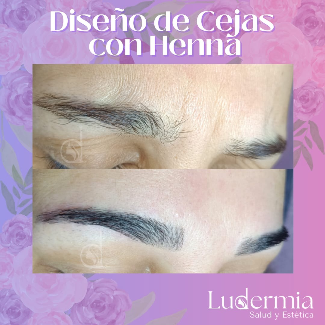 LUDERMIA SALUD Y ESTETICA