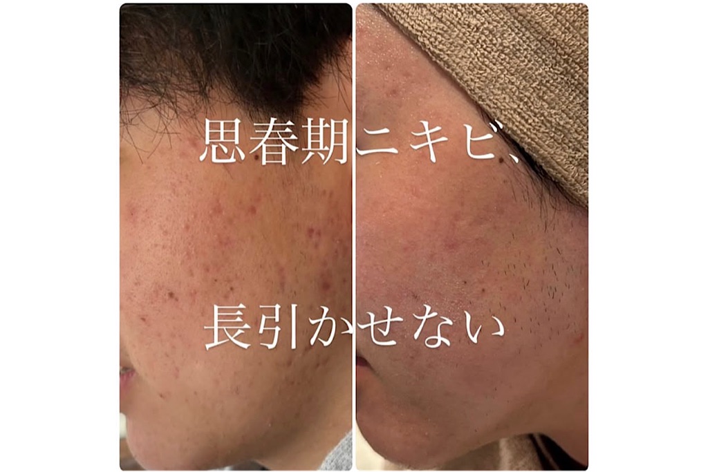 esthetic treatment QUALITY