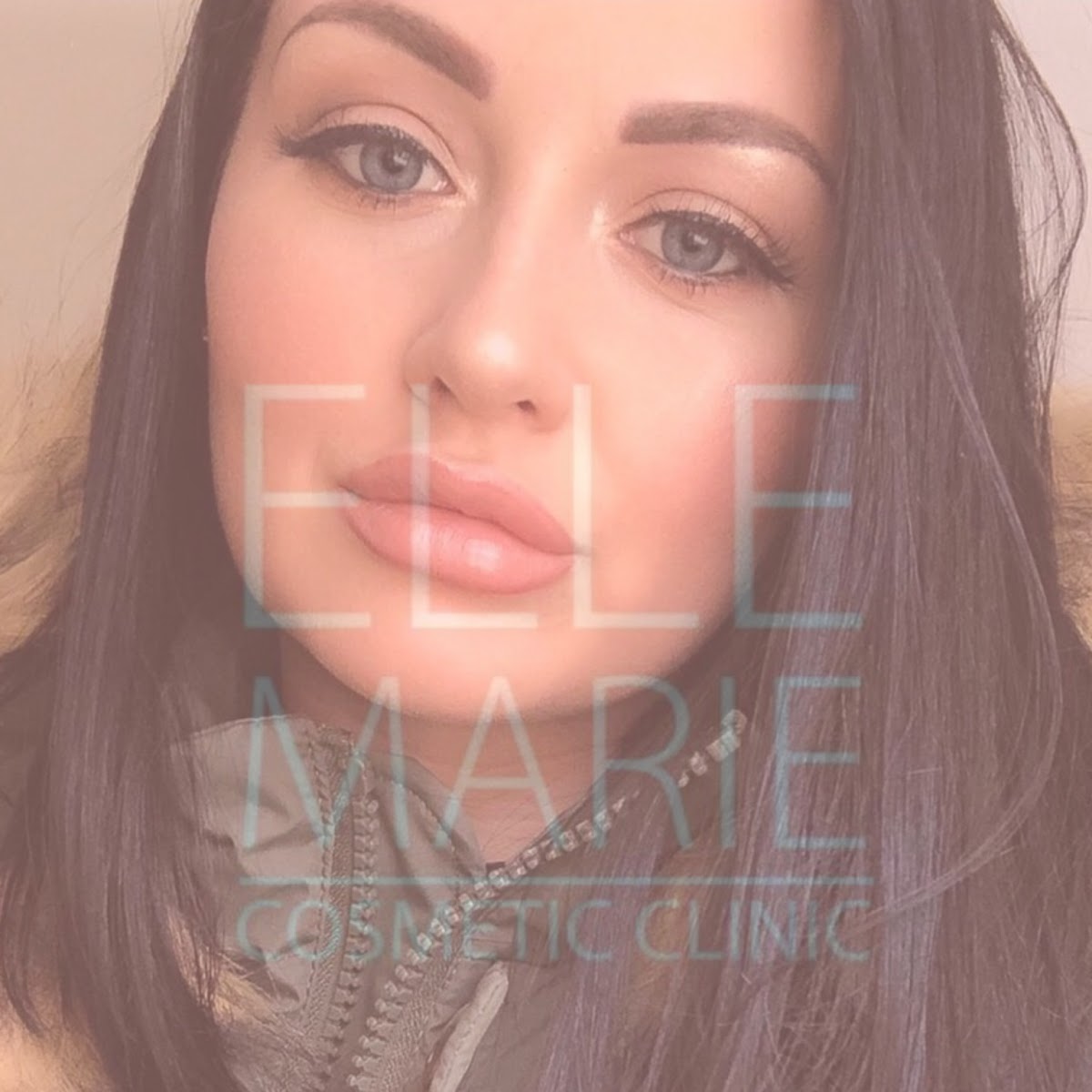 Elle Marie Cosmetic Clinic