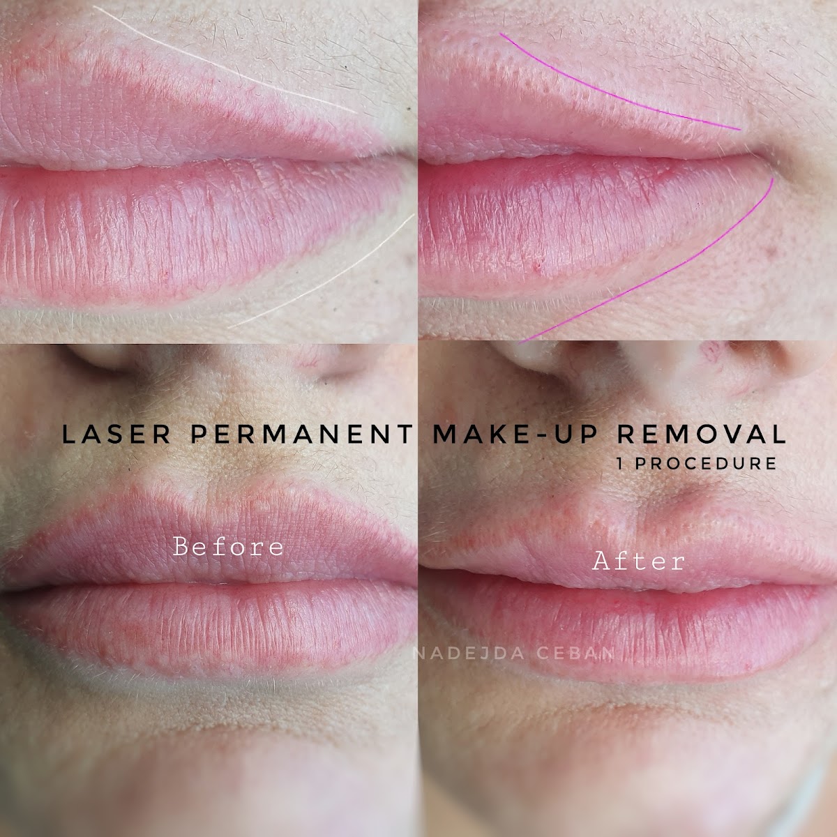 Centre SKIN Micropigmentation