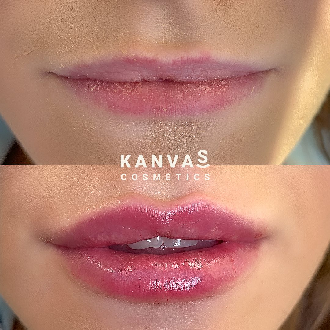 Kanvas Medical Group