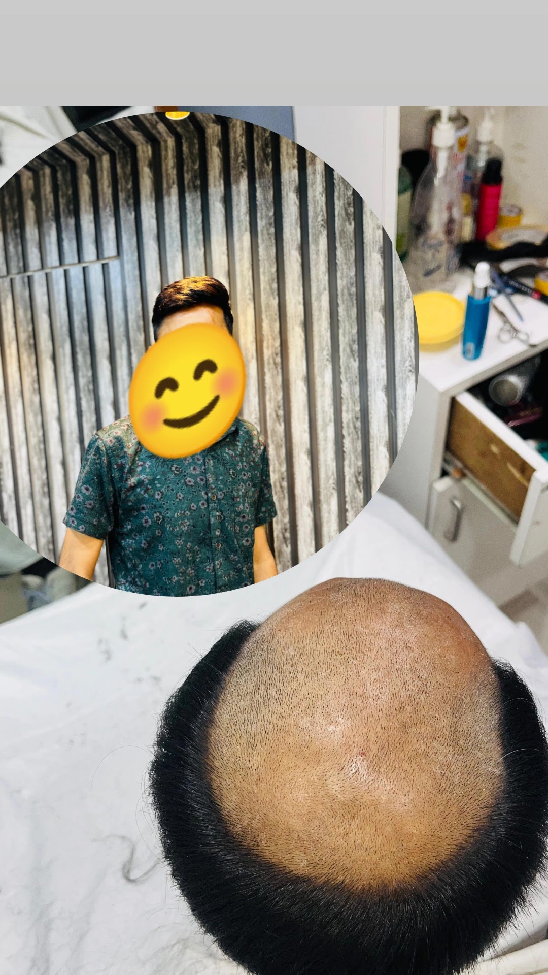Divine salon & hair WIG (patches&fixing)