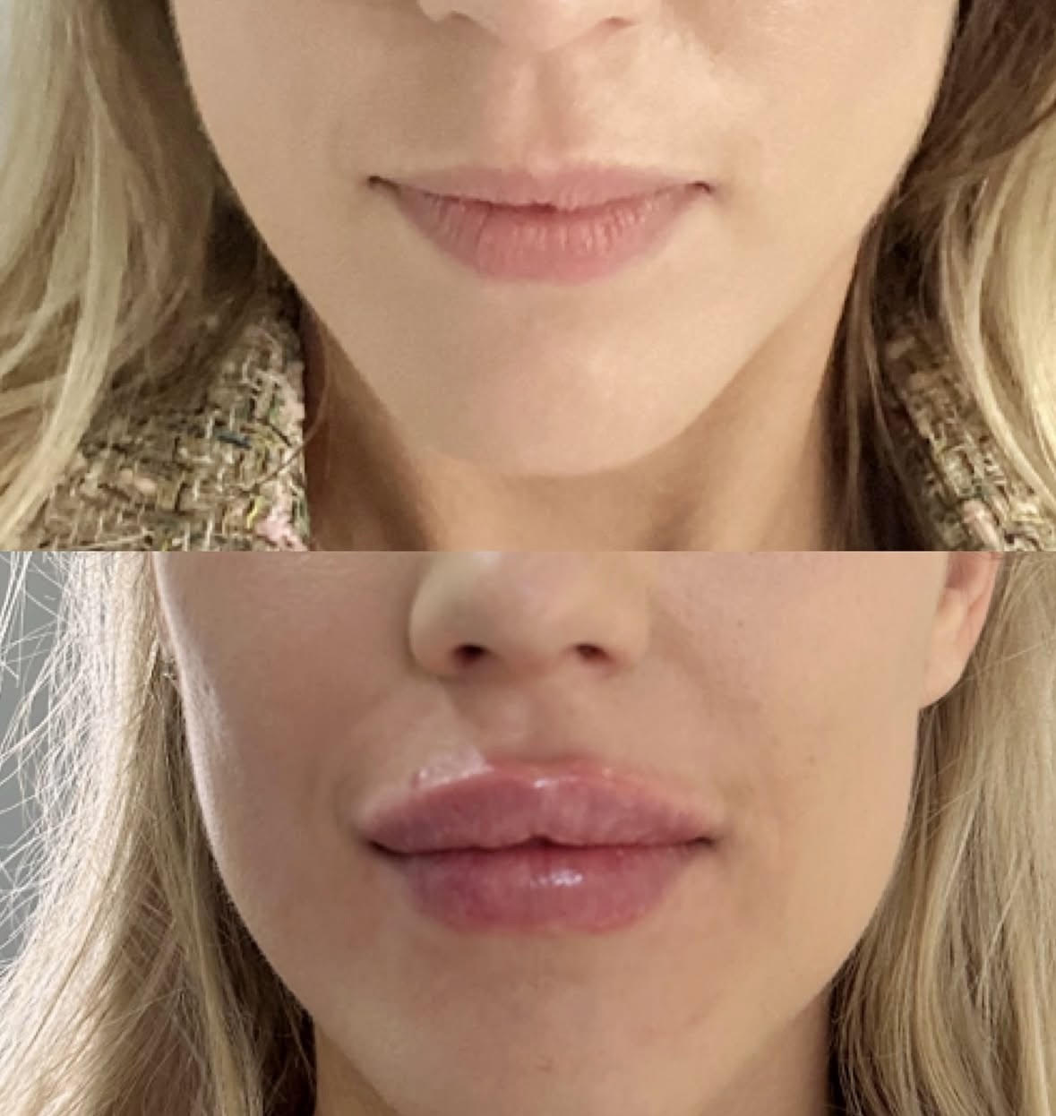 New You Cosmetic Centre