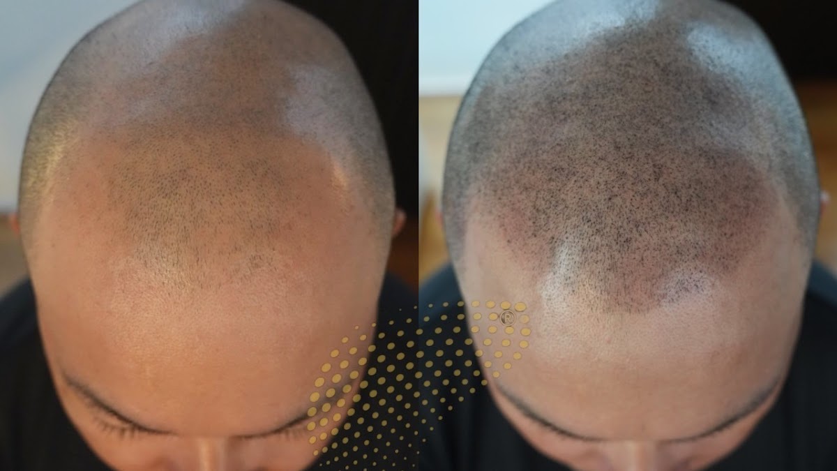AMEIRO Scalp Ink