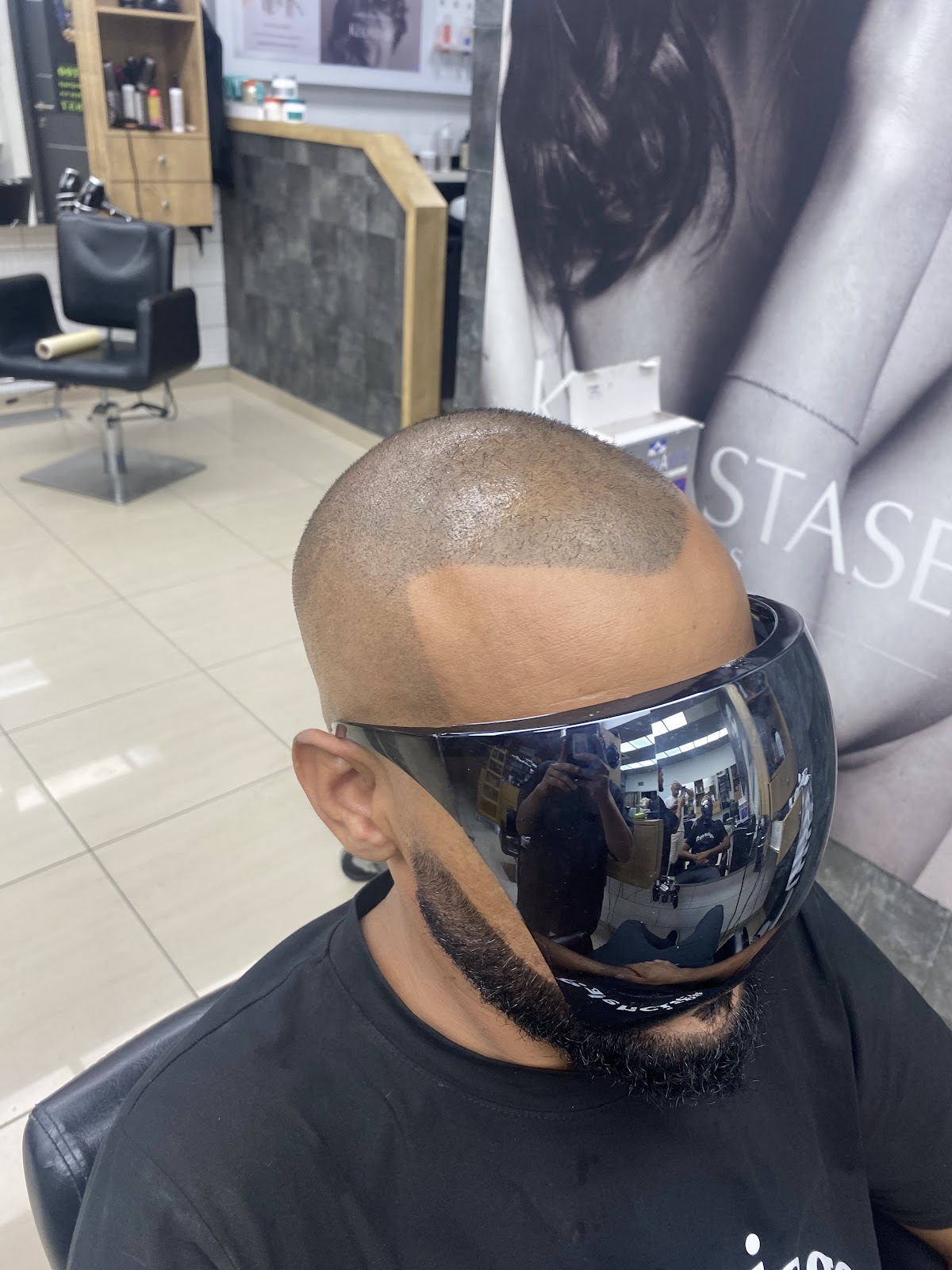 Nir Zoari | Hair Simulation Clinic for Men