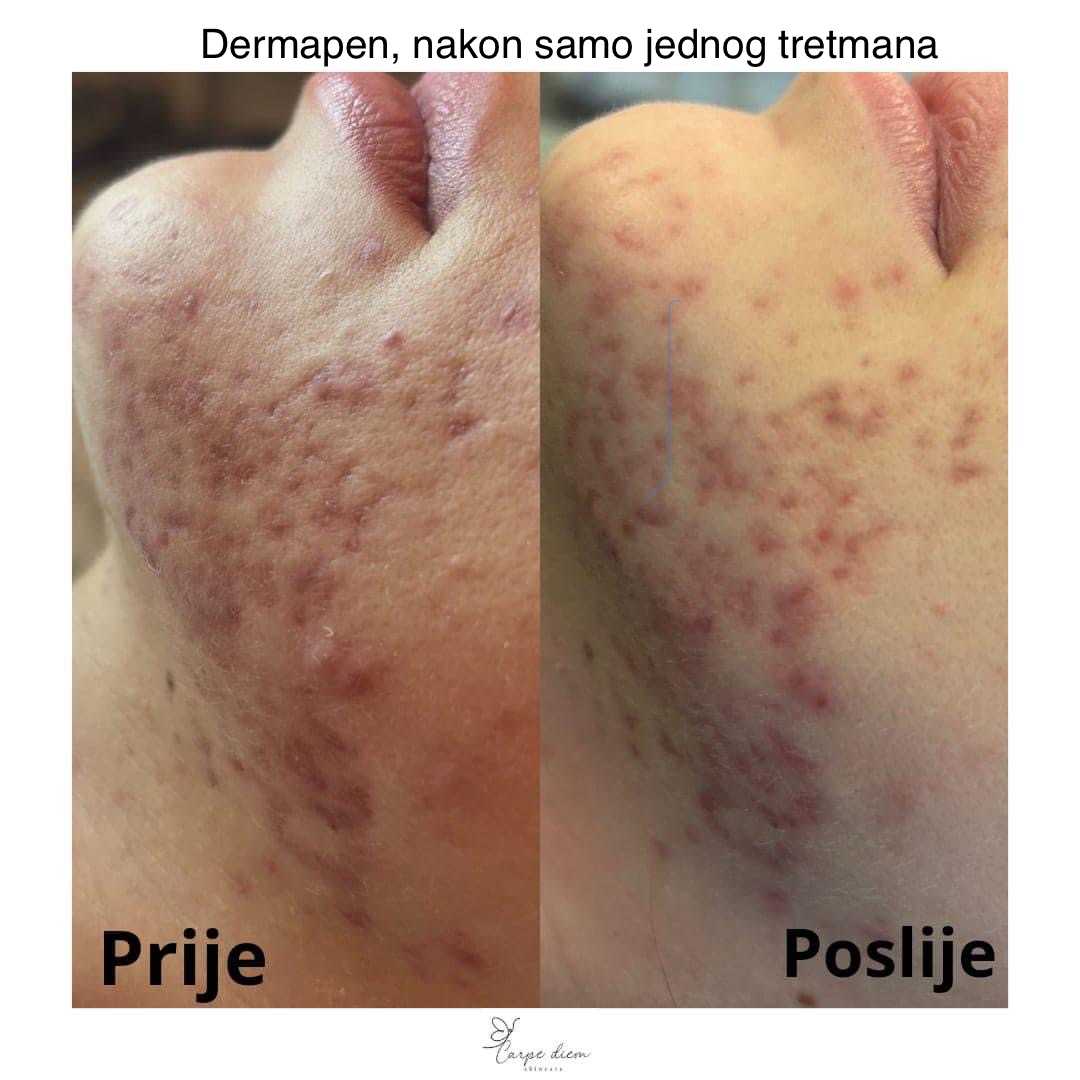 Salon za njegu lica i tijela Carpe Diem skin care