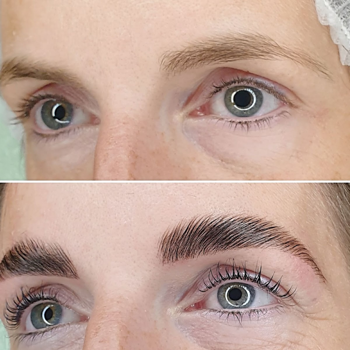 DIE HAUPTSTADTKOSMETIK spezialisiert auf Aquafacial, Microneedling, 3D & Bio-Microneedling