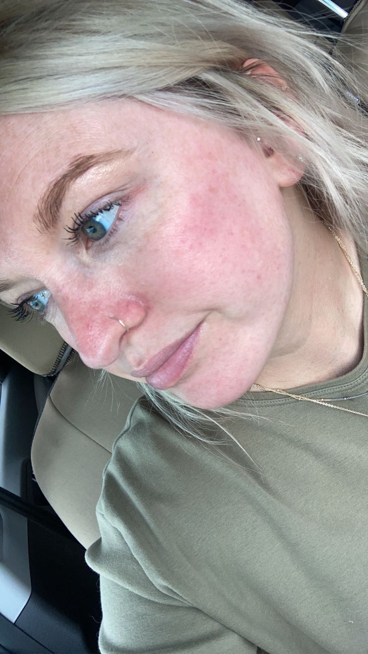 Skin by Shana