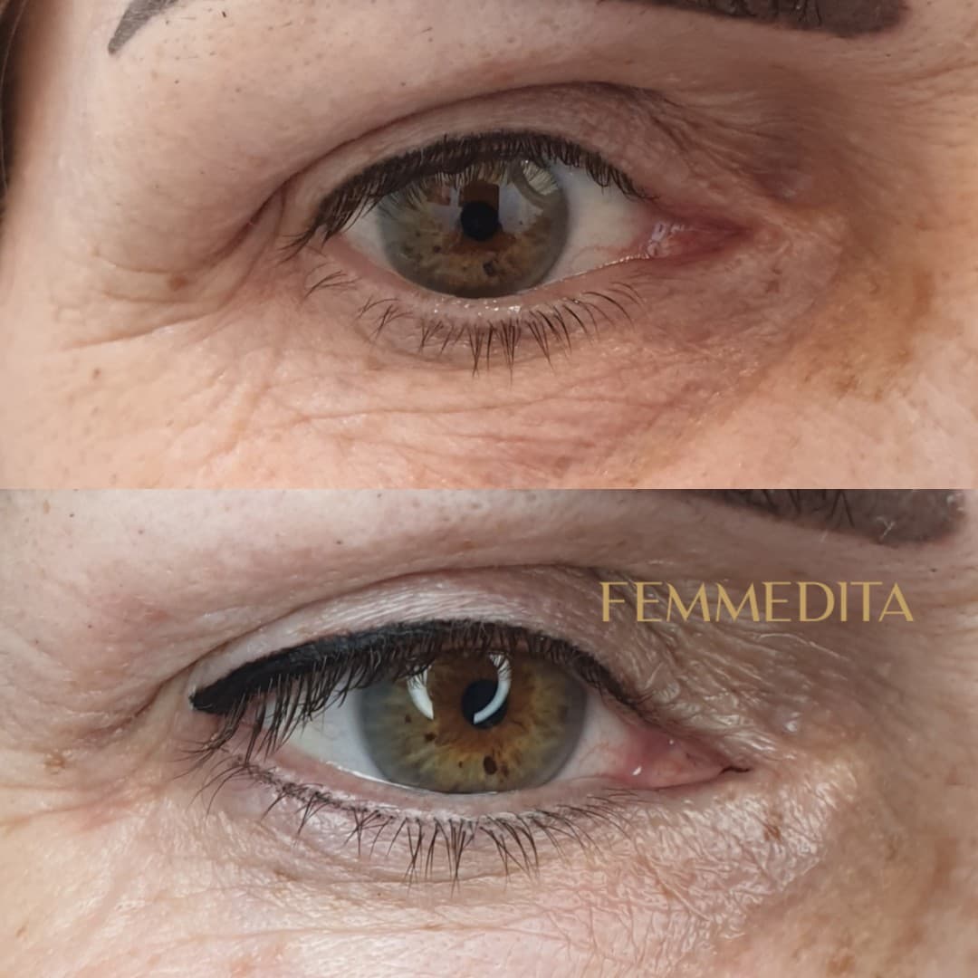 Femmedita - Kosmetologia Edyta Tyrkala