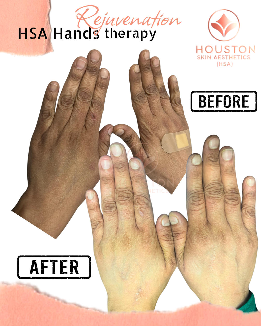 Houston Skin Aesthetics Pakistan (HSA)