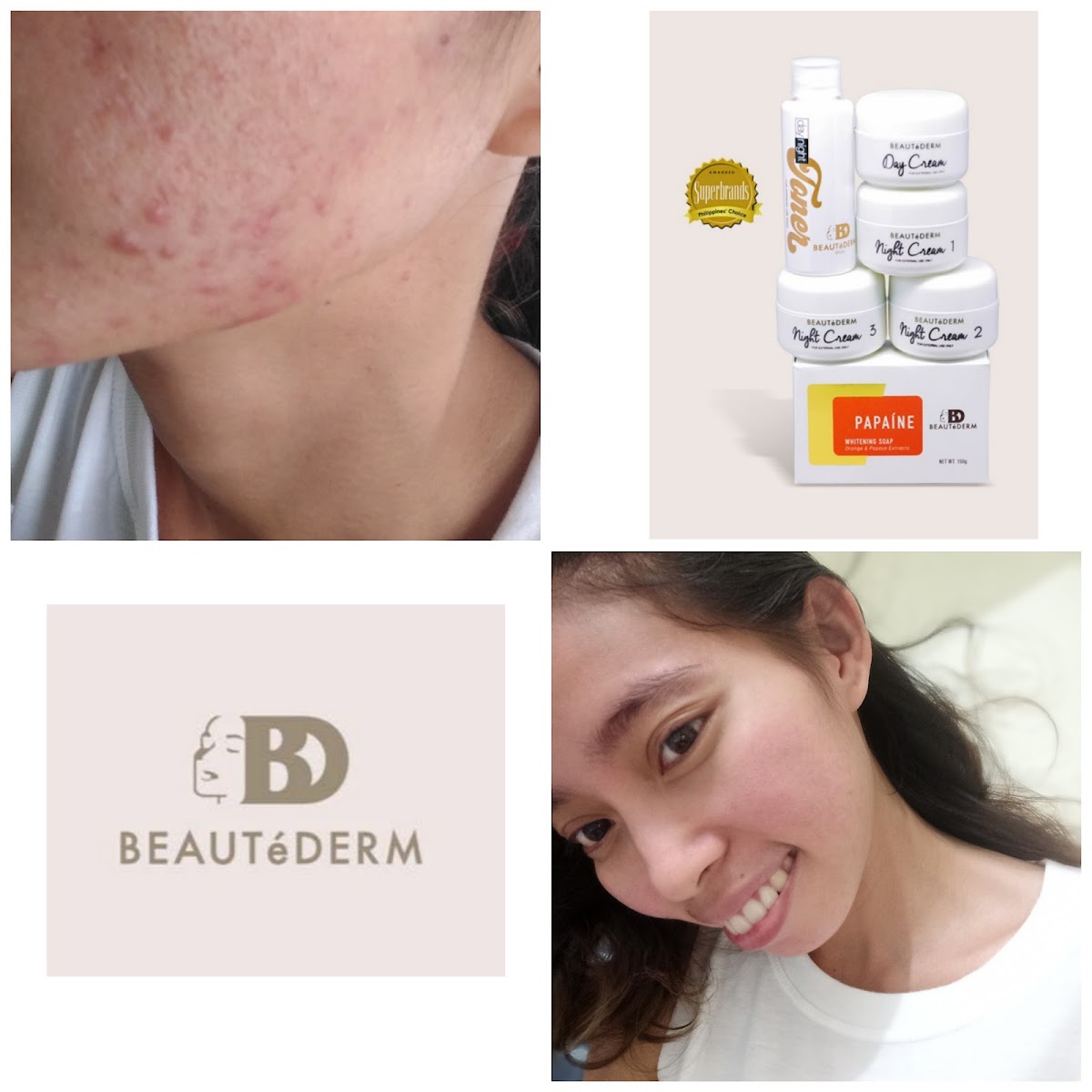 Beautederm Albay by Lab