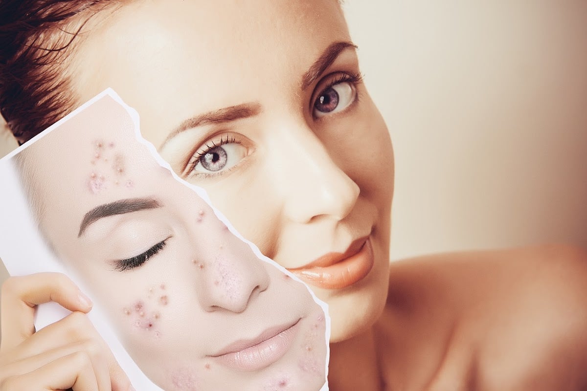 Trust Beauty Iskenderun Guzellik Merkezi