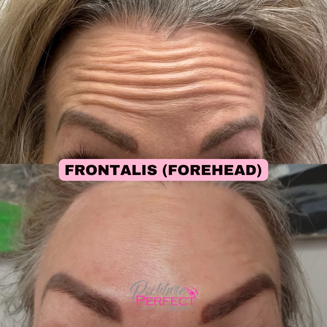 Pickture Perfect Medspa