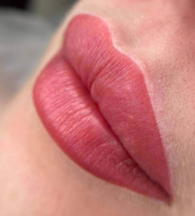 Dermafrance