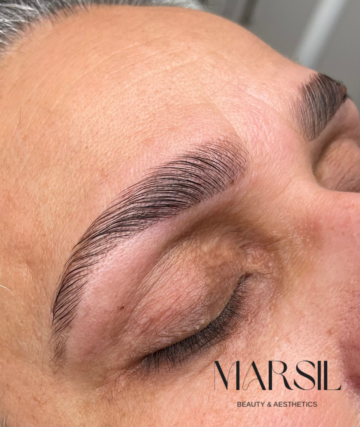 Marsil Beauty & Aesthetics