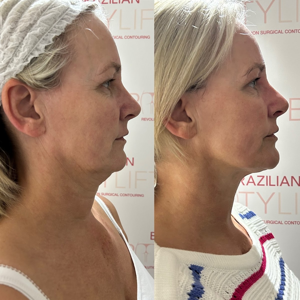 EM Beauty&BodySculpting