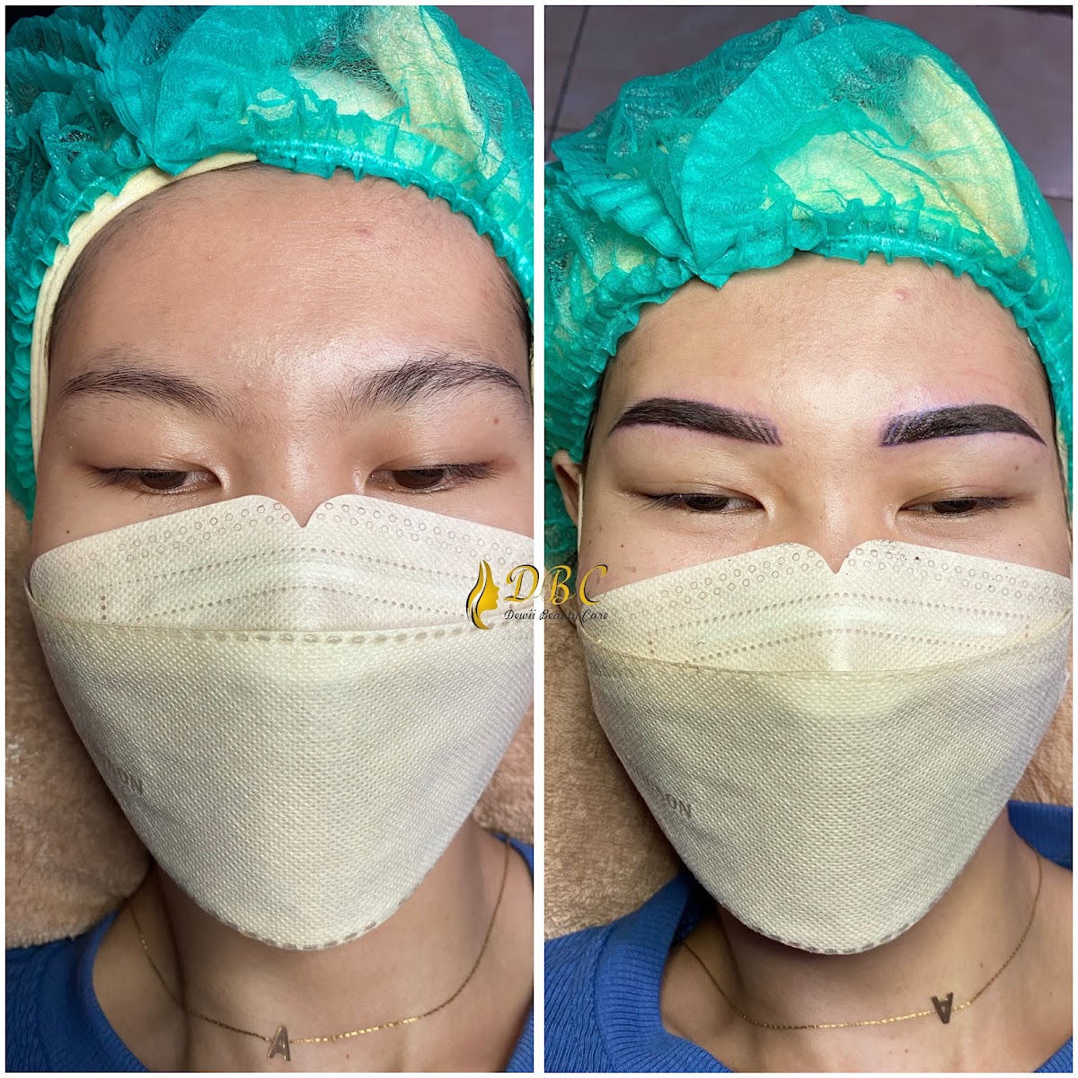 Dewii Beauty Care Bergas