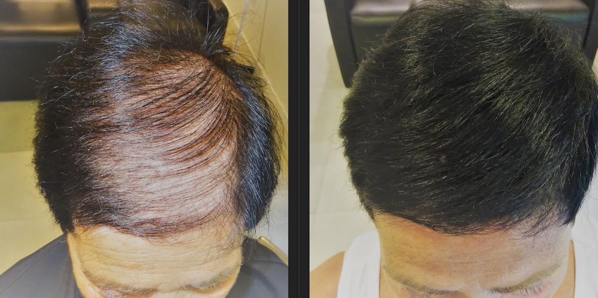 Super Million Hair Shop
