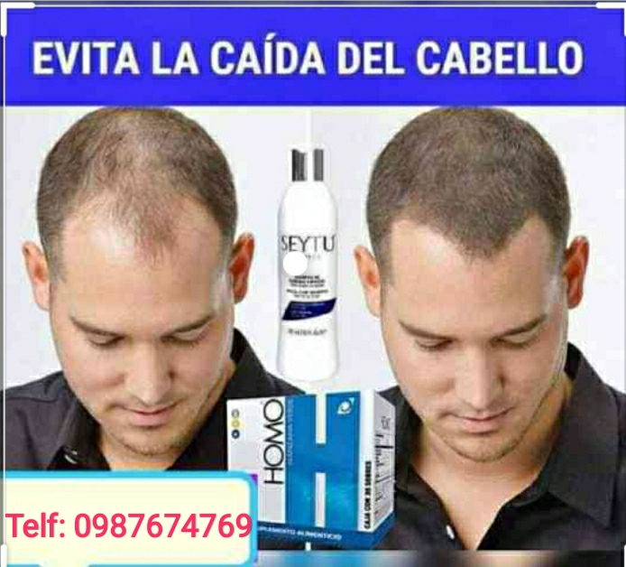 Distribuidor independiente Seytu y Omnilife